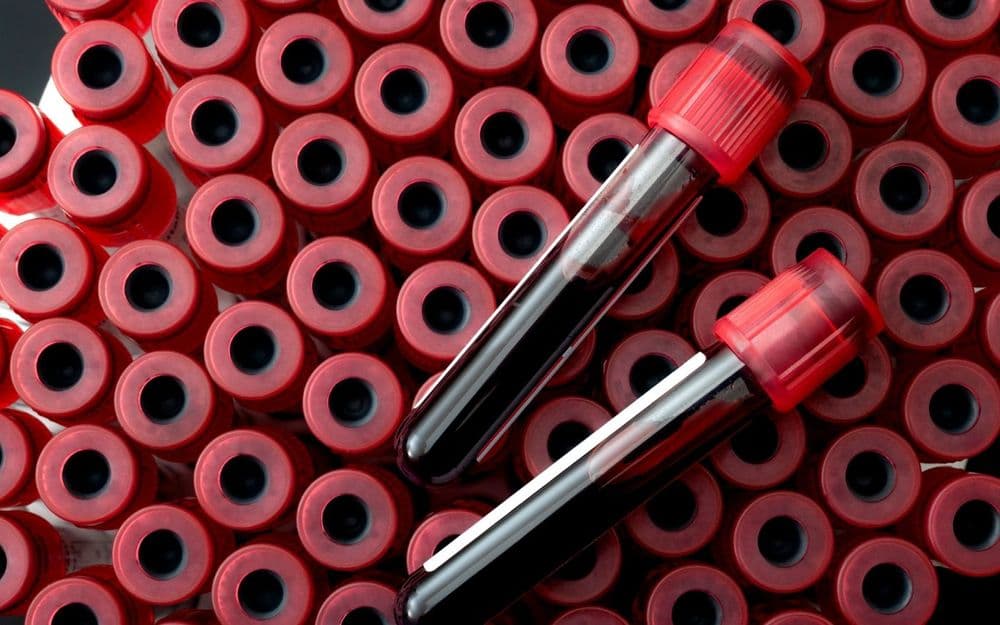 What can you find out from a blood test?