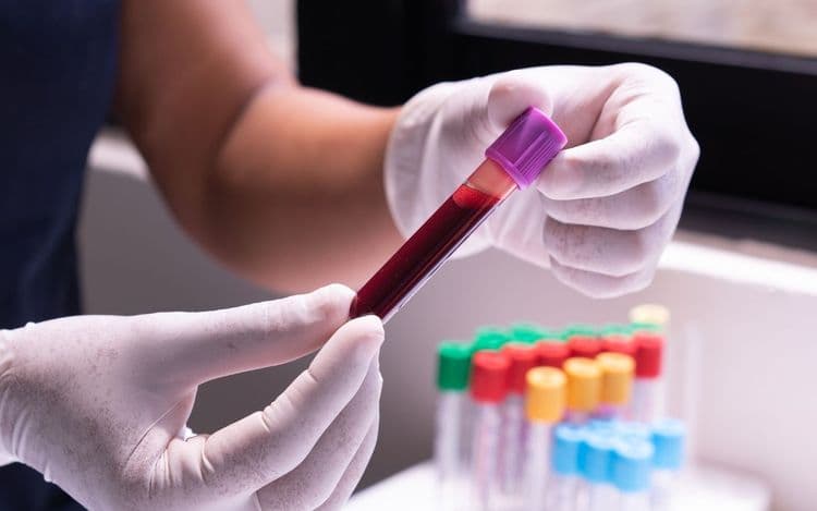 Vial of blood in a lab.